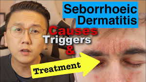 seborrhoeic dermais causes