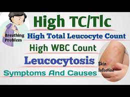 high leucocyte count ll high wbc count