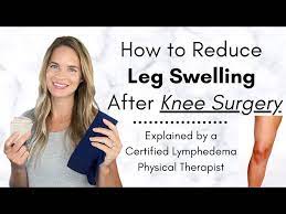 reduce leg swelling after knee surgery
