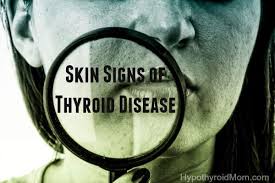 skin signs of thyroid disease