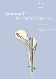 gamma3 trochanteric nail 180 stryker