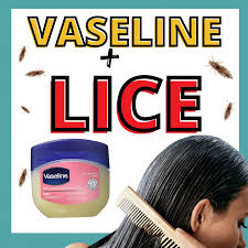 vaseline for lice does it work