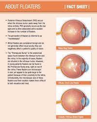 eye floater treatment chesapeake va