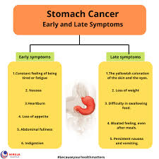 Discomfort or pain in the upper or middle part of the abdomen blood in the stool, which appears as black, tarry stools vomiting or. Stomach Cancer Early And Late Symptoms Niruja Healthtech