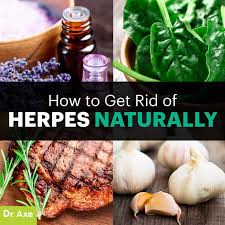 The virus most probably entered through the genitals. How To Get Rid Of Herpes Symptoms Naturally Dr Axe