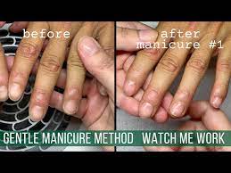 solution for hard skin around the nails