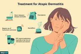 how atopic dermais is treated