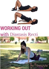safe diastasis recti exercises tips