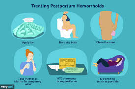 Hemorrhoids aren't a rare, strange condition. Hemorrhoids After Giving Birth At Home Treatments