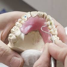 How long does it take to get false teeth after extraction? Affordable Full And Partial Dentures Houston Tx Nu Dentistry Nu Dentistry