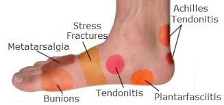 Foot Pain Diagnosis Whats Causing Your Pain
