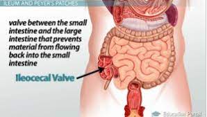 ileocecal valve dysfunction contributes
