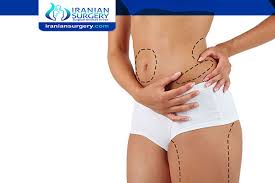 pain after liposuction flanks