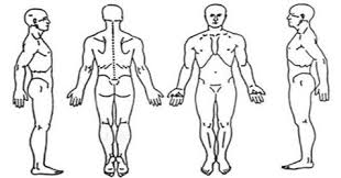Image Result For Massage Therapist Intake Form Body Chart