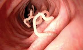 tapeworms in humans