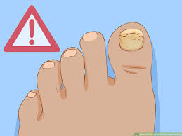 how to help a toenail grow back quickly