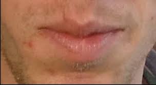 swollen lips rebecca wood