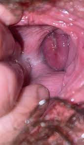 Got a real good picture of my cervix would you lick all the cum up? : r Cervix