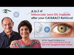 cataract or motiabind surgery