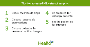 advanced iol cataract surgery