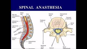 Spinal Anasthesia Interventions For Intraoperative Patients Care