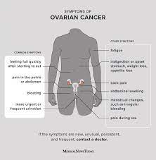 Cancer is that disease wherein uncontrolled cell growth takes place. Early Symptoms Of Ovarian Cancer What Does It Feel Like
