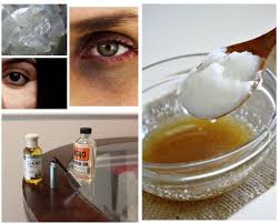 use castor oil to clear dark circles