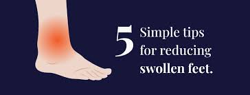 how to reduce swelling in feet rela