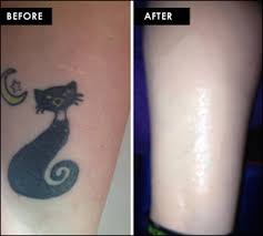 waterproof tattoo bruise scar cover up