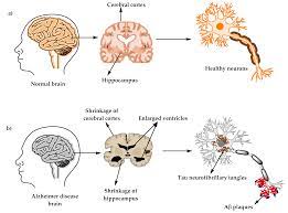 Alzheimer's is the sixth leading cause of death in the united states. Molecules Free Full Text Comprehensive Review On Alzheimer S Disease Causes And Treatment