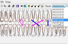Orthodontic Charting In Dom Brs Dental Office Management
