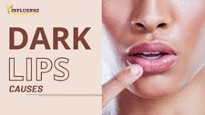 dark lips causes and treatment hoth