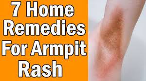 7 home remes for armpit rash you