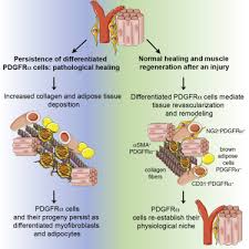 Progenitor Cells Contribute To Fibrosis