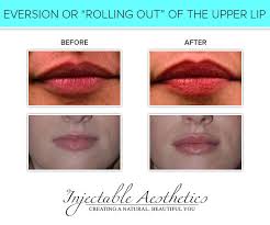 treatments injectable aesthetics