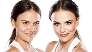 skin hyper pigmentation treatment new