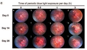 Fundus And Oct Imaging Shows That Smart Phone Like Blue