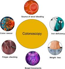 colonoscopy technologies for