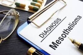 Wrongful death lawsuits for mesothelioma hold companies accountable for negligence. Mesothelioma Lawyer In Huntsville Morris King Hodge P C