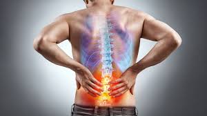 Most lower spine problems are caused by a herniated disk that presses on nerves in the spinal column. Low Back Pain Physiopedia