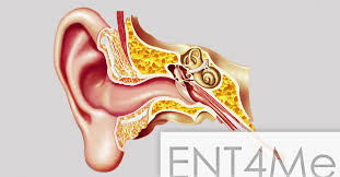 Crackling sounds that are severe or occur daily. Eustachian Tubes Pop It Like It S Hawt Mcgovern Medical School