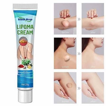 South Moon™ Lipoma Treatment Ointment | Ava Fashion BD