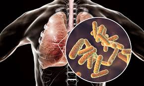 cystic fibrosis lungs feeds deadly bacteria