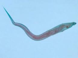 Pinworms Infection Causes Symptoms
