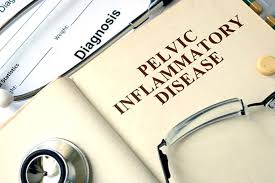 You are most welcome to from the depths stable release! What Is Pelvic Inflammatory Disease