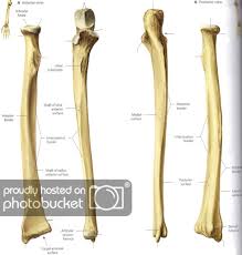 Thats So Rad Identifying And Siding The Radius Bone Broke