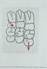 Dental Charting Symbols Flashcards Quizlet