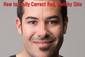 red blotchy skin in photo