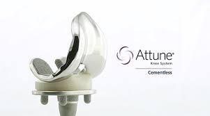 depuy synthes expands attune knee