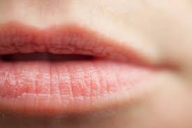chapped lips 6 tips on how to get rid